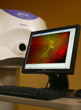 Optomap Retinal Exam